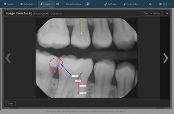 Dentrix Ascend Imaging