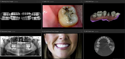 Dentrix Ascend Imaging integration